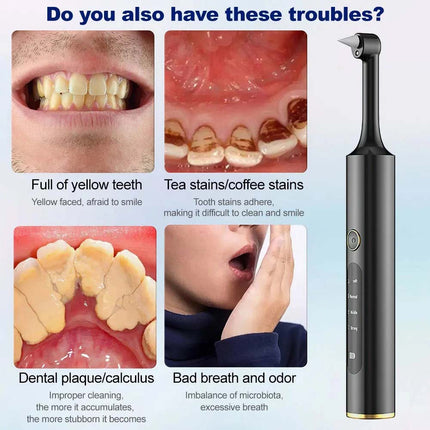 Tooth Polisher Plaque Remover for Teeth, Teeth Stain Remover Teeth Whitening Kit
