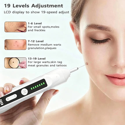 Plasma Beauty Pen for Skin Blemish Freckle & Dark Spot Pigment Correction Beauty Device White
