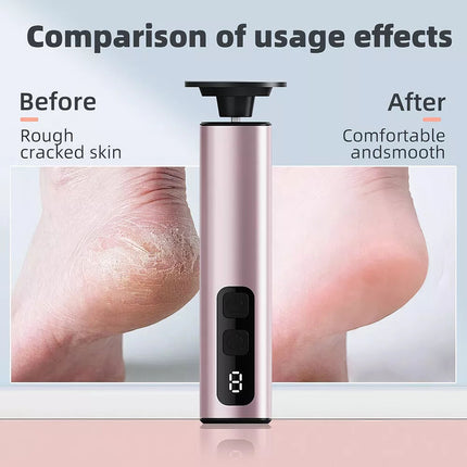 Electric Callus Remover Powerful Electric Foot File Grinder Sander Machine Speed Rose gold