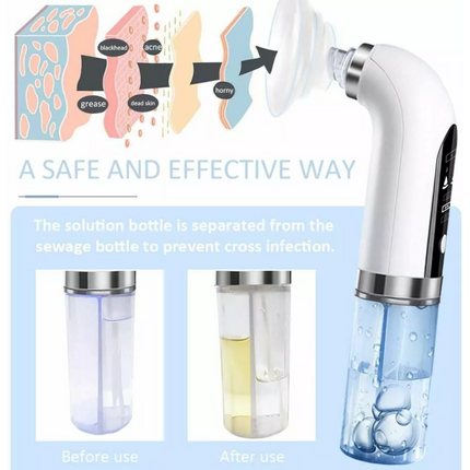 Electric Blackhead Remover Vacuum Pore Face Facial Suction Acne Cleaner Kit