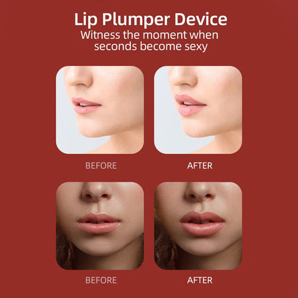 Electric Lip Plumping Enhancer Thicker Device Women Beauty Plumper Beauty Tool White