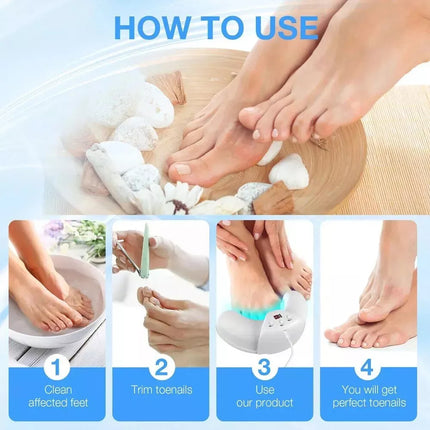 Foldable Onychomycosis Toes Nail Toenails &Fingernail Fungus Polish Curing Light