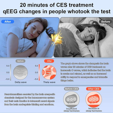 Sleep Aid CES Device With Ear Clips for Insomnia Stress Depression Migraine