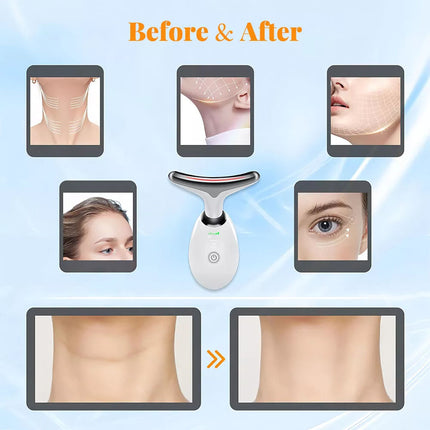Neck Lifting Anti Wrinkle Facial Massager Beauty Device Vibration LED Light Skin(White)