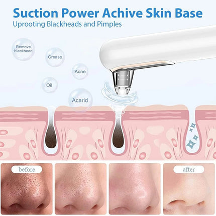 Vacuum Blackhead Remover Skin Acne Pore Pimple Extractor Suction Cleaner USB