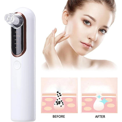 Vacuum Blackhead Remover Skin Acne Pore Pimple Extractor Suction Cleaner USB