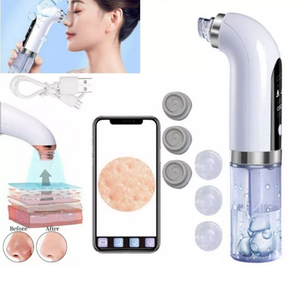 Electric Blackhead Remover Vacuum Pore Face Facial Suction Acne Cleaner Kit
