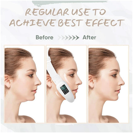 Electric Massage Double Chin Remover Face Lift Firming V-line Chin USB Recharge