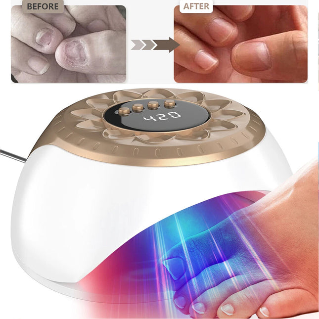 Anti-Fungal Laser Nail Treatments Repair Finger Toe Foot Care Nail Fungus Device