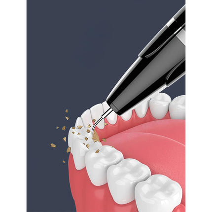 Ultrasonic Tooth Cleaner Plaque Remover Teeth Stain Tartar Calculus Remove