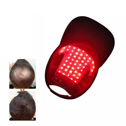 Laser&LED Red Light Therapy Cap Hair Growth Fast Regrowth Anti Hair Loss Hat