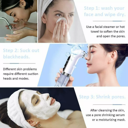 Electric Blackhead Remover Vacuum Pore Face Facial Suction Acne Cleaner Kit