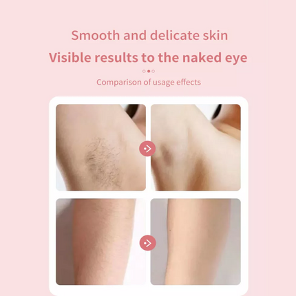 Women Pro Silk Glide Epilator Electric Shaver Razors Trimmer Bikini Hair Remover