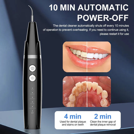 Ultrasonic Tooth Cleaner Plaque Remover Teeth Stain Tartar Calculus Remove