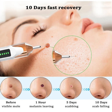 Laser Plasma Pen Skin Tag Mole Wart Freckle Dark Spot Tattoo Removal Machine