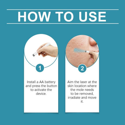 Non-Invasive Mole And Wart Removal  Skin Tag Removal Pen