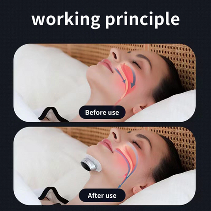 SleepEase Pro Anti-Snore Patch 2024 Smart Sleep Ease Anti Snoring Device