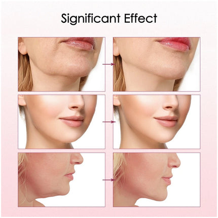 Electric Massage Double Chin Remover Face Lift Firming V-line Chin USB Recharge