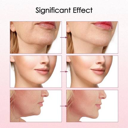 V-Face Shape Massager W/Hot Compress FunctionSkin Neck Lift Double-Chin Removal