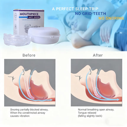 Anti-Snore Mouthpiece & Grinding Guard – Effective Sleep Aid for Snoring & Teeth Clenching