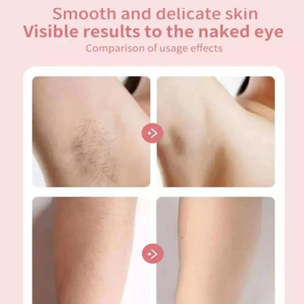 Women's Facial Epilator Hair Removal Remover USB Charging Shaver Hot  (Rechargeable Style)