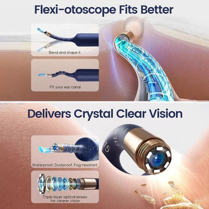 Wireless Visual Ear Wax Removal Tool HD Camera Cleaner Scoop Kit with Smart Case