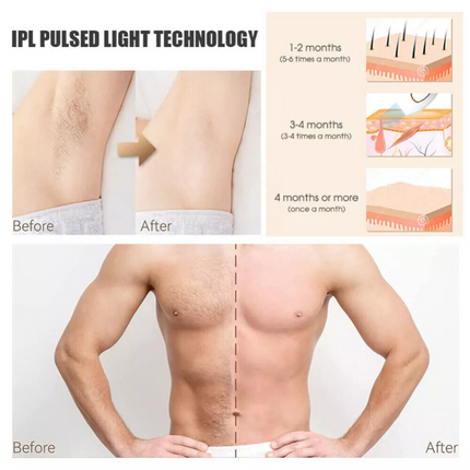 Laser Facial Whole Body IPL Hair Removal Handset Machine Permanent Men Women
