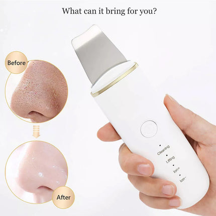 Facial Skin Scrubber Ultrasonic Dirt Cleaning Blackhead Remover Face Clean Care