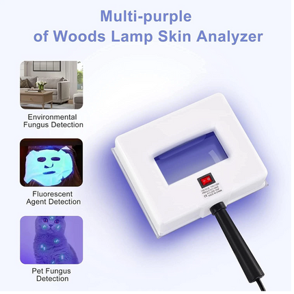 Woods Lamp Beauty Salom SPA Facial Care Analyzer UV Light Skin Diagnose Tester