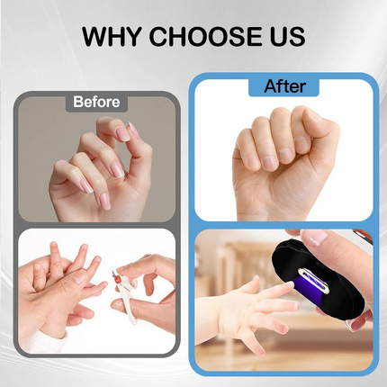 Automatic Electric Toe Nail Clippers With Light Trimmer USB Rechargeable