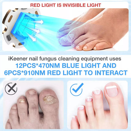 Foldable Onychomycosis Toes Nail Toenails &Fingernail Fungus Polish Curing Light
