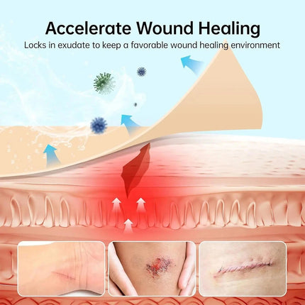 Hydrocolloid Adhesive Patches for Skin Care Daily Use 5cm*5m