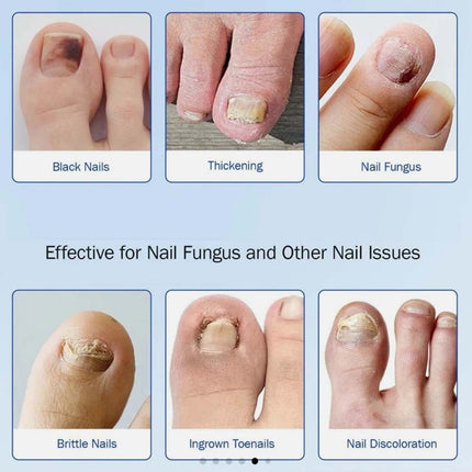 3Bag Toenail Antiseptic Patch Long Lasting Breathable Fungal Nail Patches 63Pcs