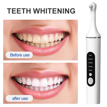 Dental Electric Teeth Polisher Cleaner Whitening Plaque Stain Remover Tool