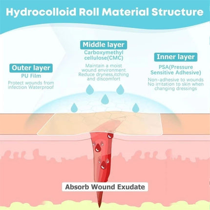 Hydrocolloid Adhesive Patches for Skin Care Daily Use 5cm*5m