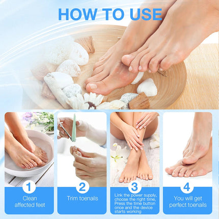 Anti-Fungal Laser Nail Treatments Repair Finger Toe Foot Care Nail Fungus Device