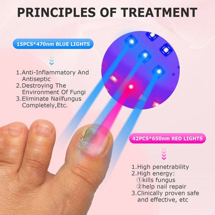 Anti-Fungal Laser Nail Treatments Repair Finger Toe Foot Care Nail Fungus Device