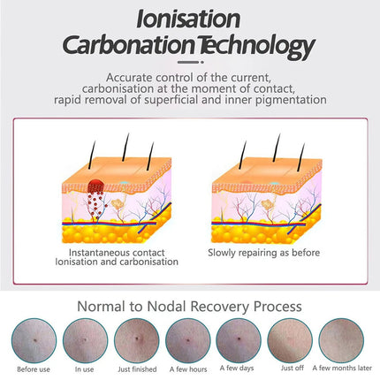 Laser Plasma Pen Mole Removal Dark Spot Remover Skin Wart Tag Remover 5x Needles