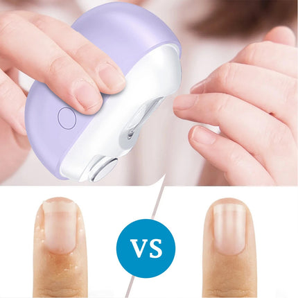 Easyclip Smart Electric Nail Clipper, 3In1 Multi-Functional Electric LED Toenail Clipper Purple