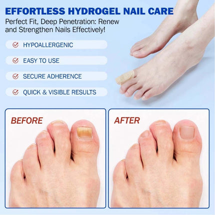 3Bag Toenail Antiseptic Patch Long Lasting Breathable Fungal Nail Patches 63Pcs