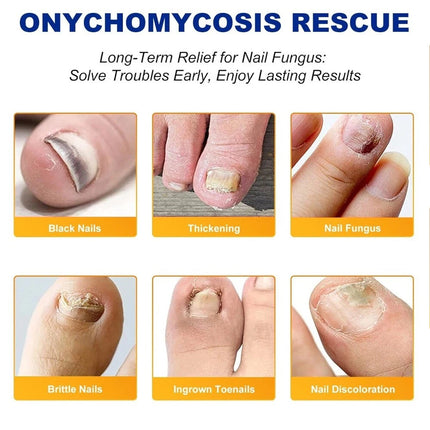 96PCS Toenail Antiseptic Patch Long Lasting Breathable Fungal Nail Patches
