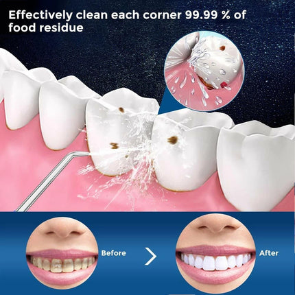 Cordless Water Flosser Jet Dental Electric Oral Irrigator Teeth Cleaner