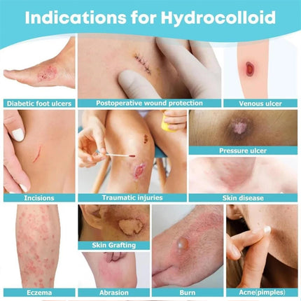 Hydrocolloid Adhesive Patches for Skin Care Daily Use 5cm*5m