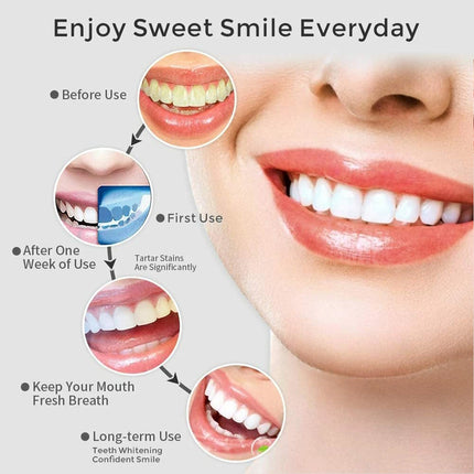 Cordless Water Flosser Jet Dental Electric Oral Irrigator Teeth Cleaner