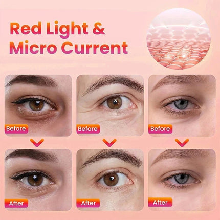 Revitaleyes Advanced Under-Eye Renewal Therapy Revital Eyes Red Light Glasses