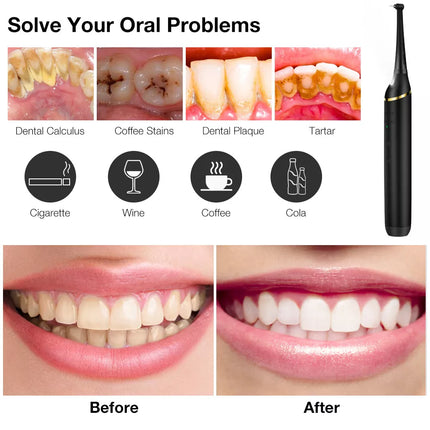 Electric Ultrasonic Tooth Stains Dental Scaler Tartar Calculus Plaque Remover