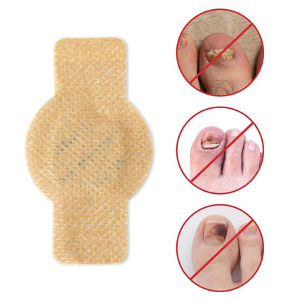 63Pcs Toenail Antiseptic Patch Long Lasting Breathable Fungal Nail Patches