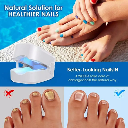 Nail Fungus Removal Treatment Cleaning Laser Therapy Device Toenail Fingernail