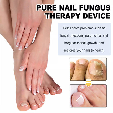 Protable Fungus Laser Therapy Device, Light Therapy Device Fungal-Nail