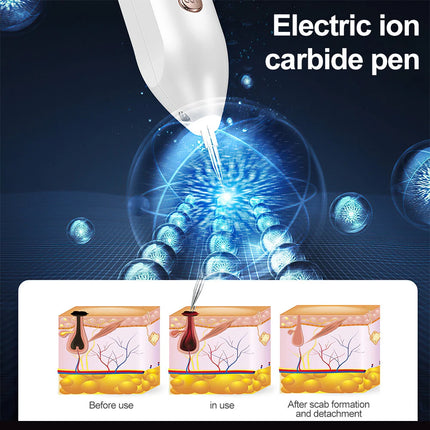 LCD Skin Tag Remover Wart Eliminator Laser Plasma Pen Papillomas Mole Removal
